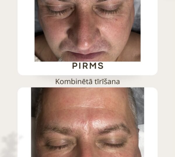 Kosmetologa pakalpojumi