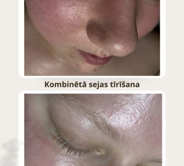 Kosmetologa pakalpojumi